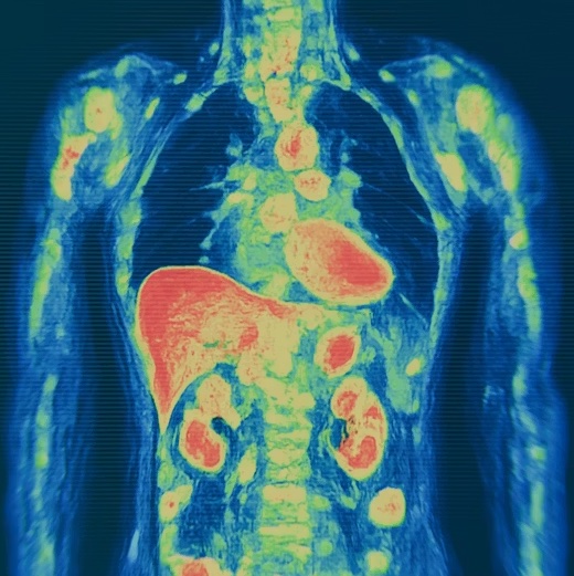 Quantification for Clinical Trials and Research Studies